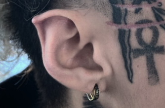 Elf Ears