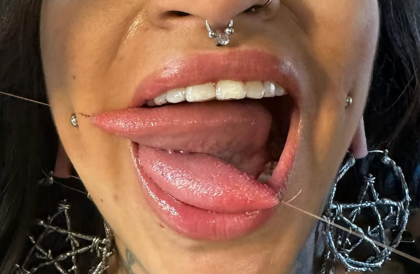 Tongue Splitting