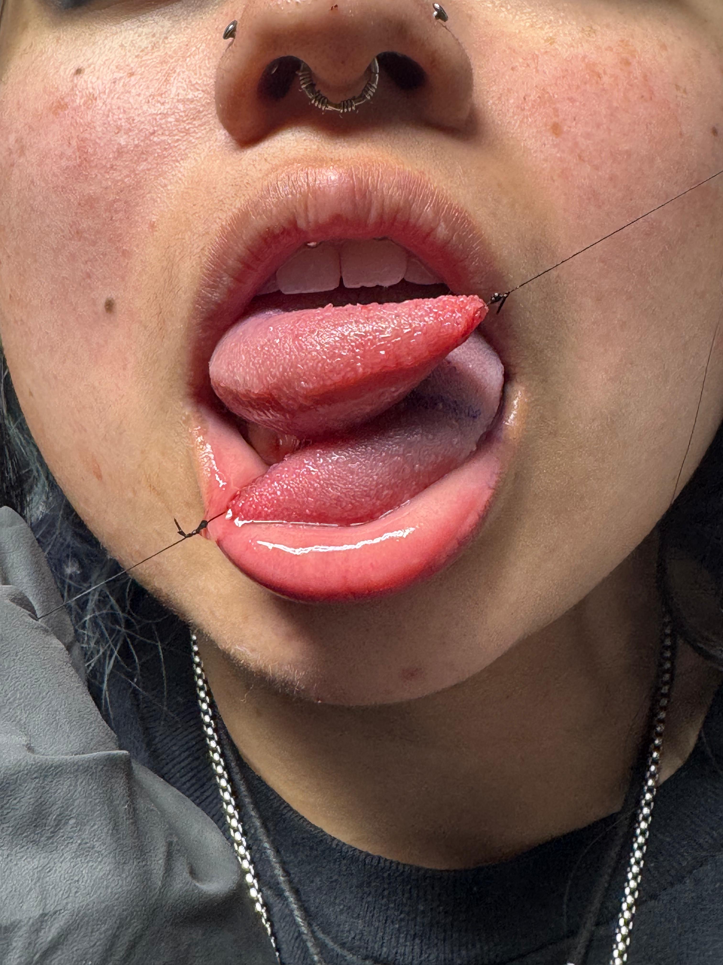 Tongue Splitting